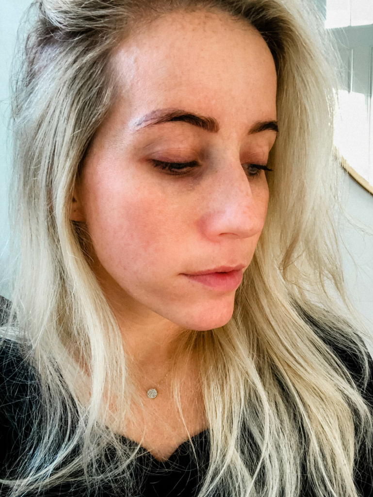 How Microblading Changed My Eyebrows and Why I'm Removing It