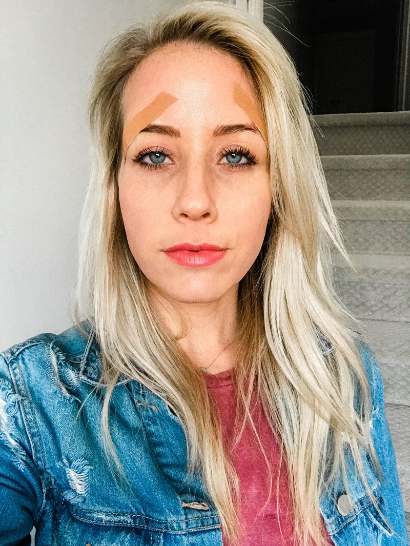 How Microblading Changed My Eyebrows and Why I'm Removing It
