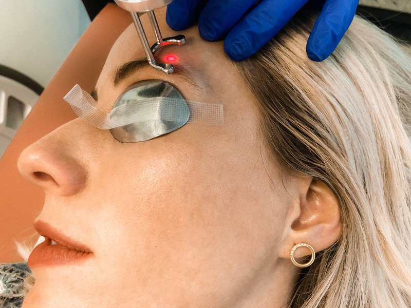 How to Get Rid of Microblading with 3 Different Solutions