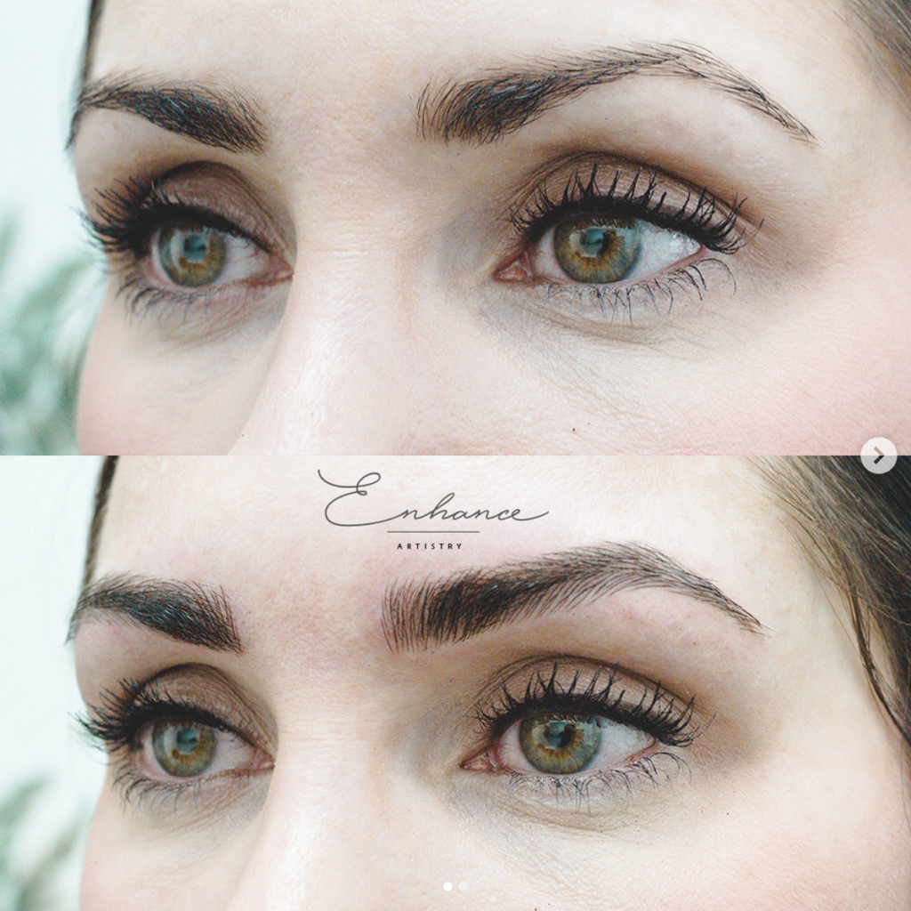 How Microblading Changed My Eyebrows and Why I'm Removing It