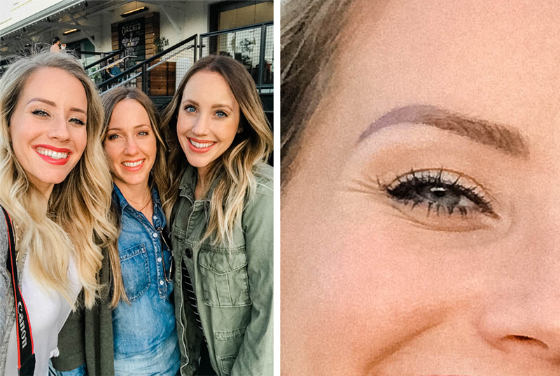 How Microblading Changed My Eyebrows and Why I'm Removing It