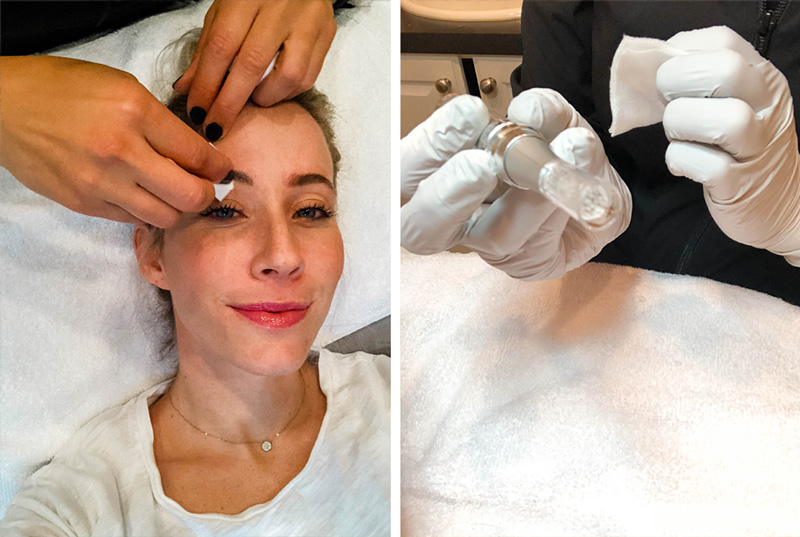 How to Get Rid of Microblading with 3 Different Solutions