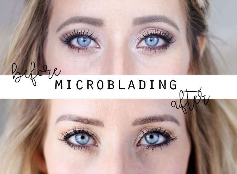 How Microblading Changed My Eyebrows and Why I'm Removing It
