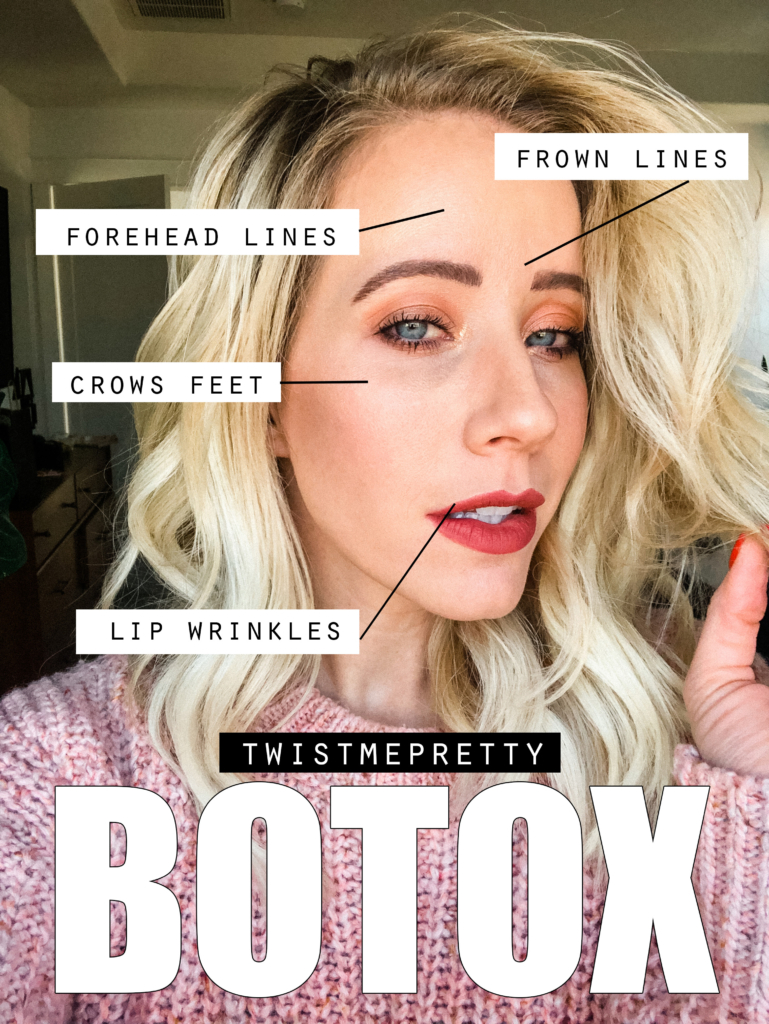 The truth about Botox- how to not look frozen www.twistmepretty.com